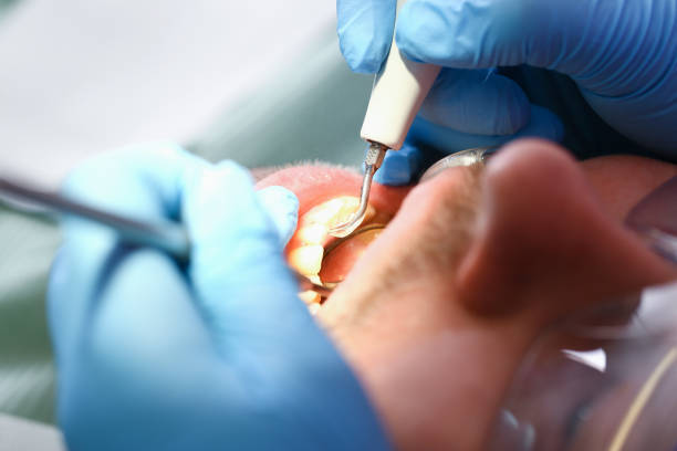 Best Emergency Treatment for Oral Infections in Pearl City, HI